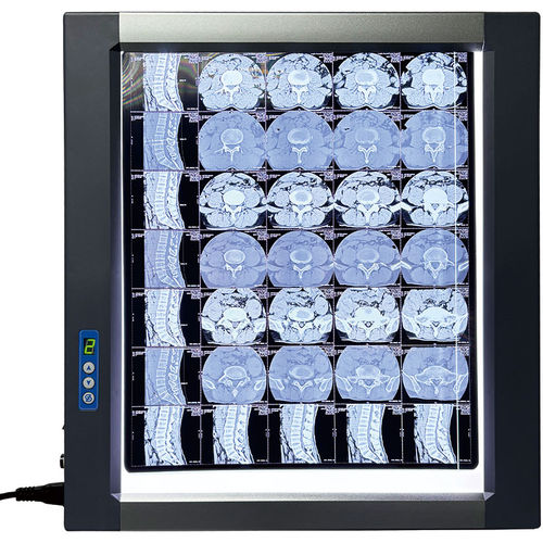 Negatoscopio LED - MST-4000I - Shantou Easywell Electronic Technologies - digital / 1 pantalla