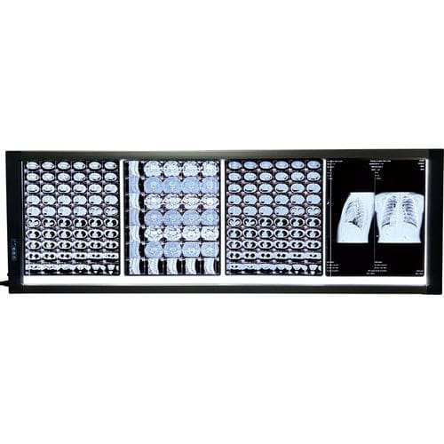 Negatoscopio digital - MST-4000IV  - Shantou Easywell Electronic Technologies - 4 pantallas / LED
