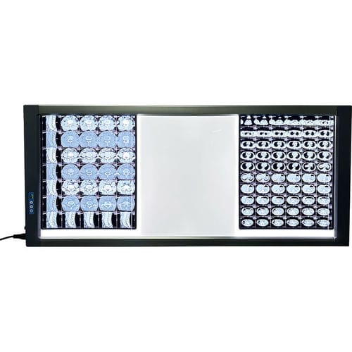 Negatoscopio digital - MST-4000III - Shantou Easywell Electronic Technologies - 3 pantallas / LED