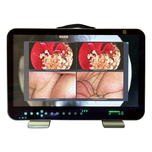 Cámara de vídeo para endoscopio - E43 - Shantou Easywell Electronic Technologies - para odontología / veterinaria / de vigilancia