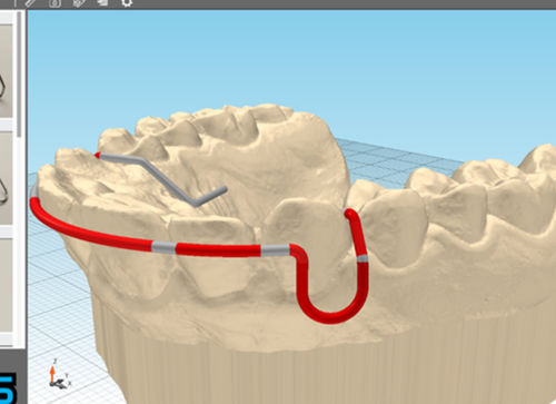 Software de fabricación - JawDraw® - Advanced Orthodontic Solutions  - para odontología