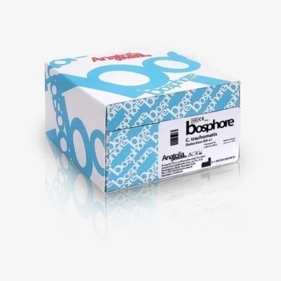 Kit de prueba de SIDA - Bosphore  - Anatolia Tani ve Biyoteknoloji A.S - de hepatitis B / de hepatitis C / de hepatitis A