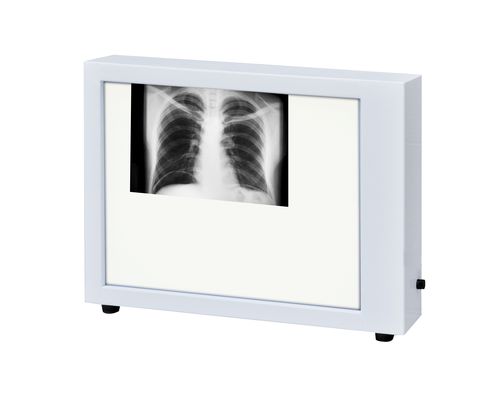 Negatoscopio 1 pantalla - N-1 - Zapovit - vertical / LED