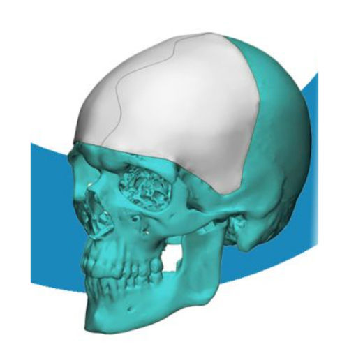Implante craneal a medida - 4350 - Poriferous