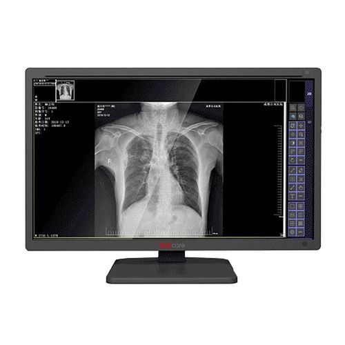 Monitor médico - MDS-C series - Shenzhen Juding Medical Equipment Co.,Ltd. - de diagnóstico / para imágenes médicas / de radiología
