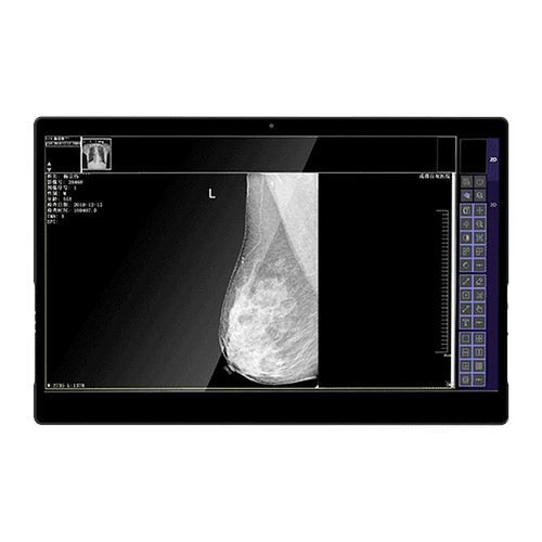 Monitor médico - IVS-8MP - Shenzhen Juding Medical Equipment Co.,Ltd. - de diagnóstico / para imágenes médicas / mamográfico