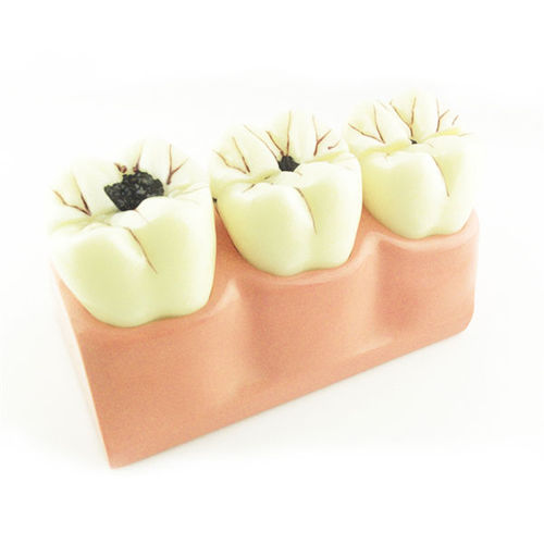 Modelo anatómico de dientes - UM-L10 4 - Tangshan UMG Medical Instrument - de formación / de caries / de resina