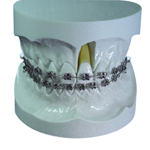Modelo anatómico de dentadura - UM-S11 - Tangshan UMG Medical Instrument - para ortodoncia / de demostración
