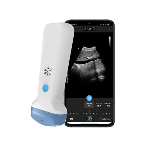 Ecógrafo de mano - S35C - Beijing iTrason Technologies - para ecografía ginecológica y obstétrica / para ecografías abdominales y pélvicas / para ecografía en urgencias médicas