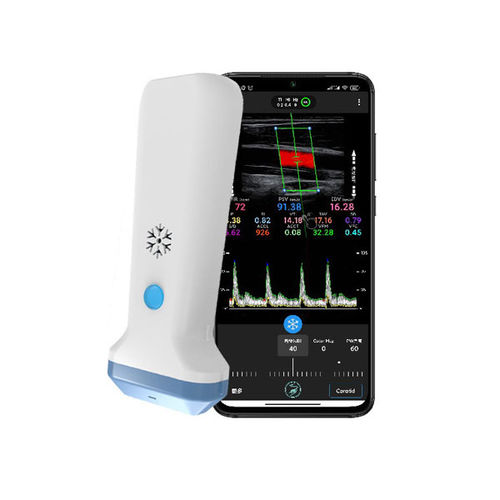 Ecógrafo de mano - S35L - Beijing iTrason Technologies - para ecografía en urgencias médicas / para ecografía de mama / para ecografía musculoesquelética