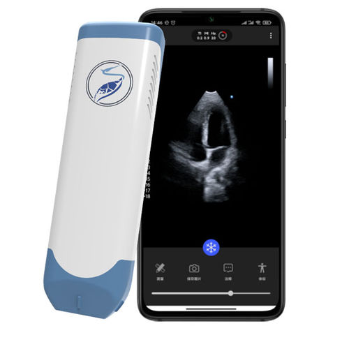 Ecógrafo de mano - Lite31P - Beijing iTrason Technologies - para ecografía cardiovascular / blanco y negro / Doppler espectral