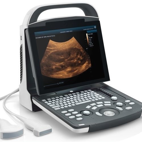 Ecógrafo portátil - DP10 - Beijing iTrason Technologies - para ecografía polivalente / para ecografía ginecológica y obstétrica / para ecografías abdominales y pélvicas