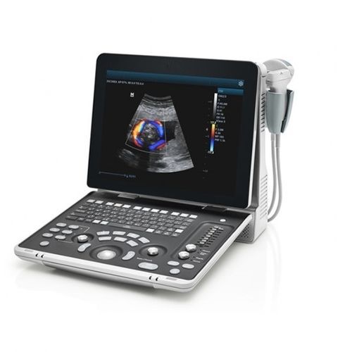 Ecógrafo portátil - Z50 - Beijing iTrason Technologies - para ecografía polivalente / para ecografías abdominales y pélvicas / para ecografía urológica