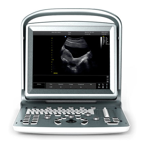 Ecógrafo portátil - eco5 - Beijing iTrason Technologies - para ecografía polivalente / para ecografía ginecológica y obstétrica / para ecografías abdominales y pélvicas