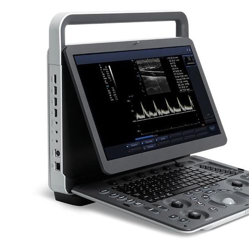 Ecógrafo portátil - E2 - Beijing iTrason Technologies - para ecografía polivalente / para ecografía ginecológica y obstétrica / para ecografías abdominales y pélvicas