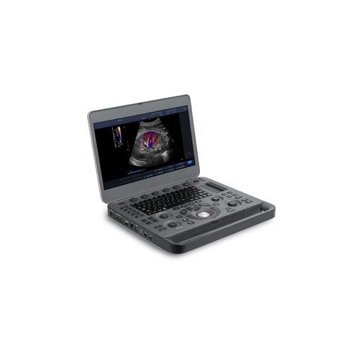 Ecógrafo portátil - X3 - Beijing iTrason Technologies - para ecografía polivalente / para ecografía ginecológica y obstétrica / para ecografías abdominales y pélvicas