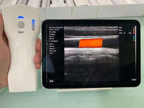 Ecógrafo de mano - CL - Beijing iTrason Technologies - para ecografía ginecológica y obstétrica / para ecografías abdominales y pélvicas / para ecografía urológica