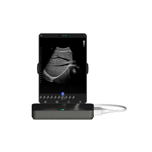 Ecógrafo portátil - Cloud - Beijing iTrason Technologies - para ecografía polivalente / para ecografía en urgencias médicas / para ecografía de mama