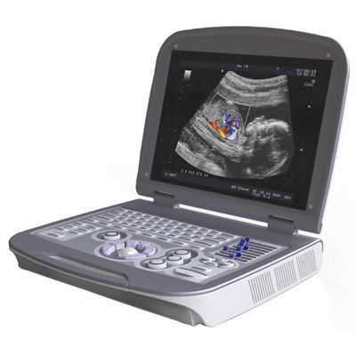 Ecógrafo portátil - 6600PLUS - Mianyang Sonic Electronic - para ecografía polivalente / blanco y negro / doppler-color
