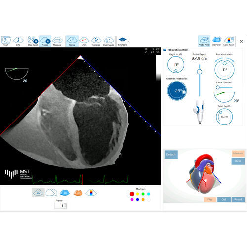 Software médico - eTEEmothy - Medical Simulation Technologies - para ecografía / para ecocardiografía / para cardiología