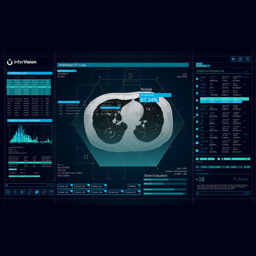 Software de análisis - Beijing Infervision Technology Co. Ltd. - para informes / de tratamiento / de validación