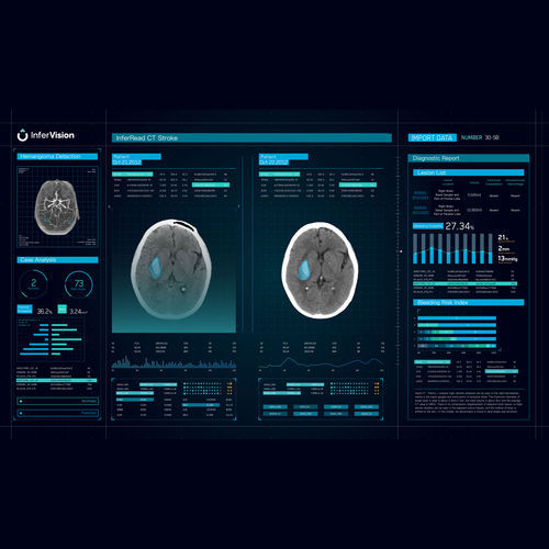 Software de gestión de alarmas - CT Stroke - Beijing Infervision Technology Co. Ltd. - de tratamiento / para identificación de variantes / médico