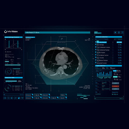 Software de análisis - Bone - Beijing Infervision Technology Co. Ltd. - de análisis de imágenes / de detección / médico