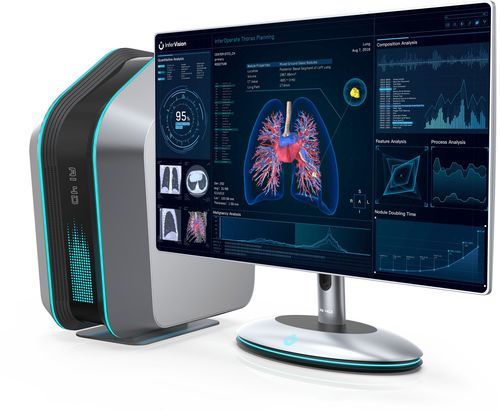 Software médico - InferOperate® - Beijing Infervision Technology Co. Ltd. - para cirugía / quirúrgico / clínico