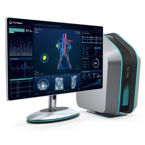 Software preoperatorio - InferOperate® Suite - Beijing Infervision Technology Co. Ltd. - urología / para cirugía / de detección de contornos