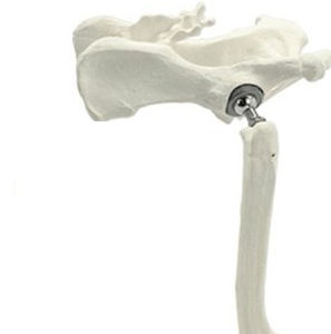 Prótesis de cadera veterinaria cementada - THR - Anhui Bailu Small Animal Orthopedic Instrument - para artroplastia total de cadera