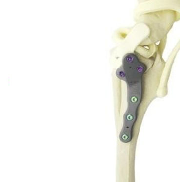 Placa de compresión ósea veterinaria de patas - TPLO - Anhui Bailu Small Animal Orthopedic Instrument