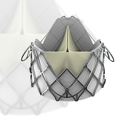 Bioprótesis valvular aórtica - J-Valve™ - Suzhou Jiecheng Medical Technology - de tejido porcino / de nitinol / sin suturas