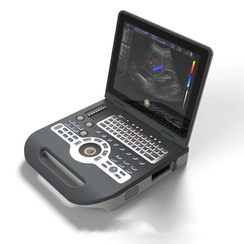 Ecógrafo portátil - FTL-UTS1600 - Fatali Medical - para ecografía ginecológica y obstétrica / para ecografías abdominales y pélvicas / doppler-color