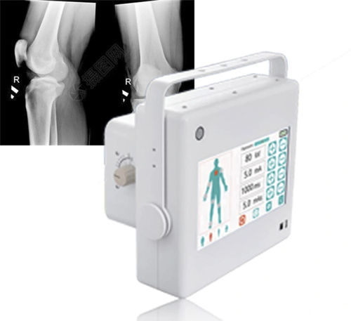 Generador de rayos X para radiografía polivalente - FTLF10 - Fatali Medical - portátil / con panel de control / con batería
