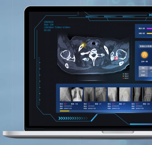 PACS con computación en la nube - NovaCloud® - Huiying Medical Technology (Beijing) Co., Ltd. - médico