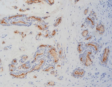Reactivo en solución - FHM0010 - Celnovte Biotechnology Co., Ltd. - para inmunohistoquímica / de marcadores tumorales / del ratón