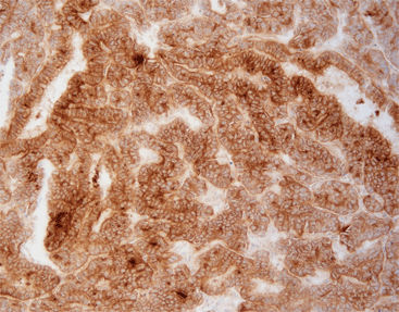 Reactivo anticuerpos - FGM0011 - Celnovte Biotechnology Co., Ltd. - para el cáncer / a base de animales