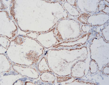 Reactivo de tejidos - FCM0080 - Celnovte Biotechnology Co., Ltd. - para inmunohistoquímica / de glicoproteínas