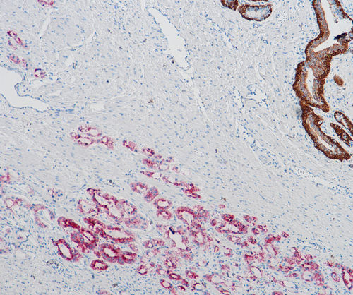 Kit de reactivos solución de coloración - SD8009 - Celnovte Biotechnology Co., Ltd. - de tejidos / para el cáncer / para inmunohistoquímica