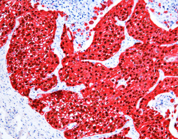 Kit de reactivos solución de coloración - SD8001 - Celnovte Biotechnology Co., Ltd. - para inmunohistoquímica / de fosfatasa alcalina / cromogénico
