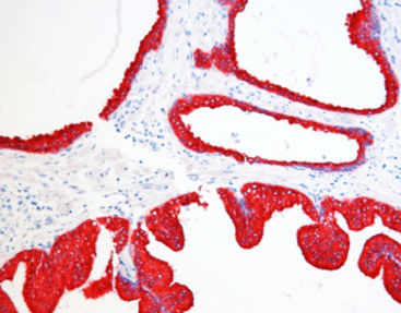 Kit de reactivos colorante - SD8006 - Celnovte Biotechnology Co., Ltd. - de tejidos / para inmunohistoquímica / de fosfatasa alcalina