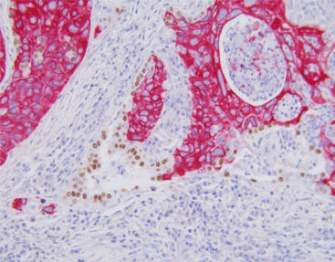 Kit de reactivos solución de coloración - SD8103 - Celnovte Biotechnology Co., Ltd. - de tejidos / para inmunohistoquímica