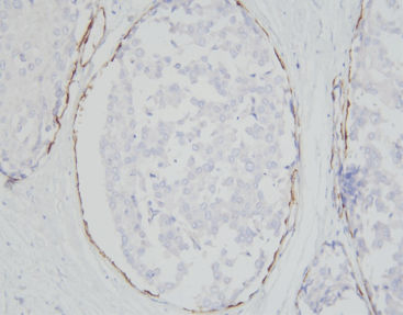 Kit de reactivos solución de coloración - SD8105 - Celnovte Biotechnology Co., Ltd. - de tejidos / para inmunohistoquímica