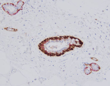 Kit de reactivos solución de coloración - SD8106 - Celnovte Biotechnology Co., Ltd. - de tejidos / para inmunohistoquímica