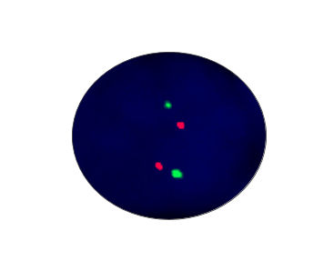 Kit de prueba de fiebre tifoidea - CF1003 - Celnovte Biotechnology Co., Ltd. - para la investigación / para el cáncer / de oncología