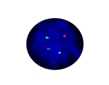 Kit de prueba de gen de fusión EML4-ALK - CF1012 - Celnovte Biotechnology Co., Ltd. - de fiebre tifoidea / para la investigación / de cáncer de pulmón