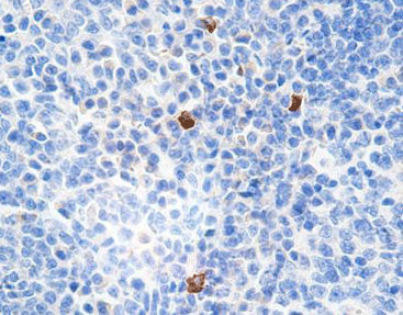 Reactivo de inmunoglobulina G4 - CIR-0131 - Celnovte Biotechnology Co., Ltd. - solución de coloración / anticuerpo monoclonal / anticuerpo policlonal