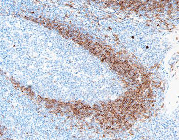Reactivo solución de coloración - CIR-0111 - Celnovte Biotechnology Co., Ltd. - anticuerpos / colorante / para citología