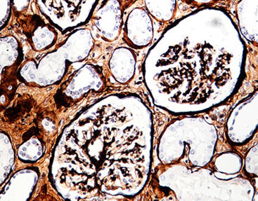 Kit de reactivos solución de coloración - Celnovte Biotechnology Co., Ltd. - de diagnóstico / para histologia / líquido