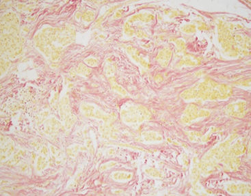 Kit de reactivos solución de coloración - Van Gieson - Celnovte Biotechnology Co., Ltd. - para histologia